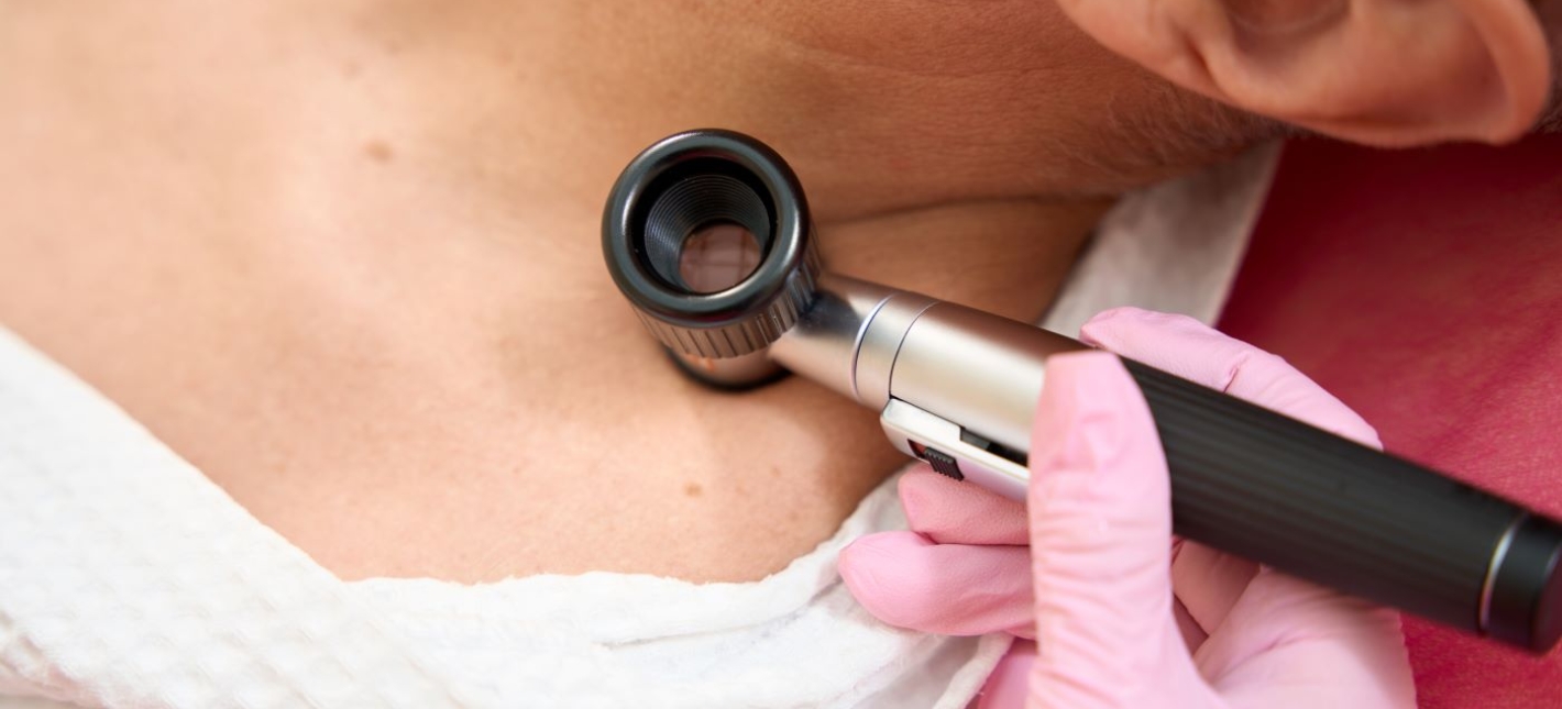 Образования на коже. Удалять или нет?