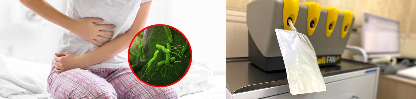 Дыхательный тест с С13 мочевиной для диагностики Helicobacter pylori
