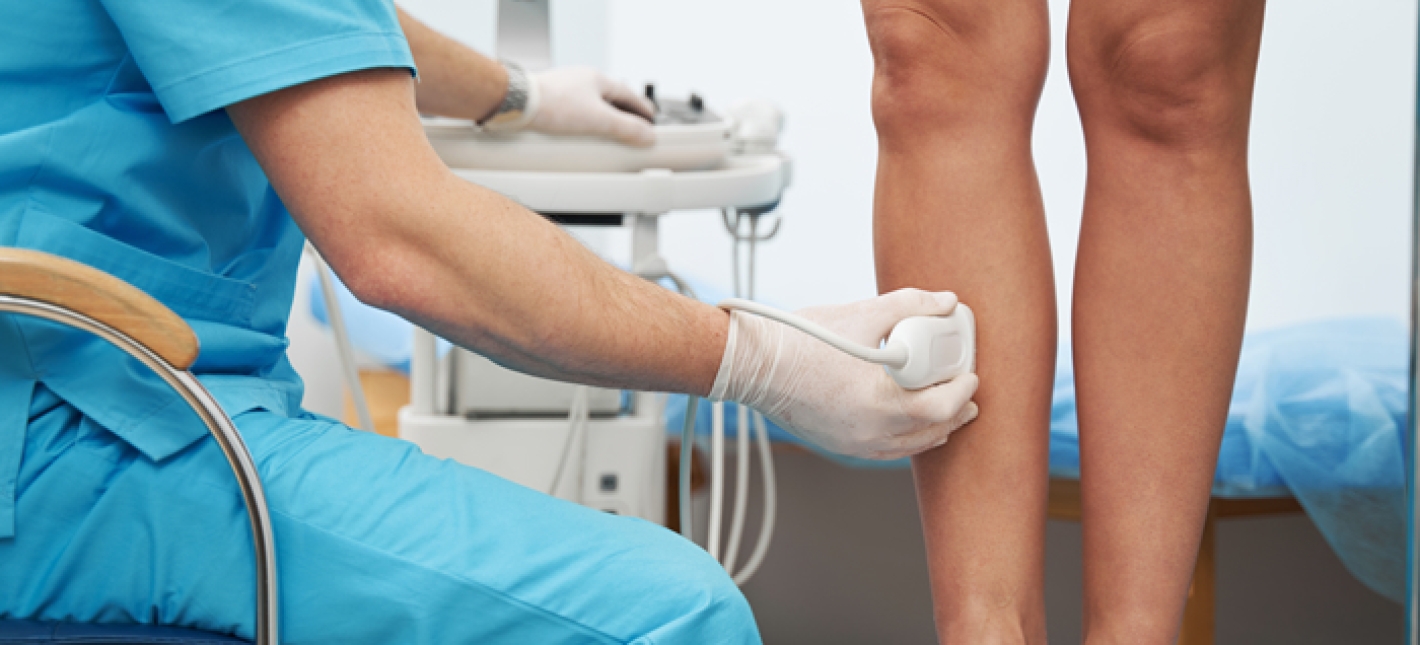 Консультация флеболога с УЗИ поверхностных вен ног