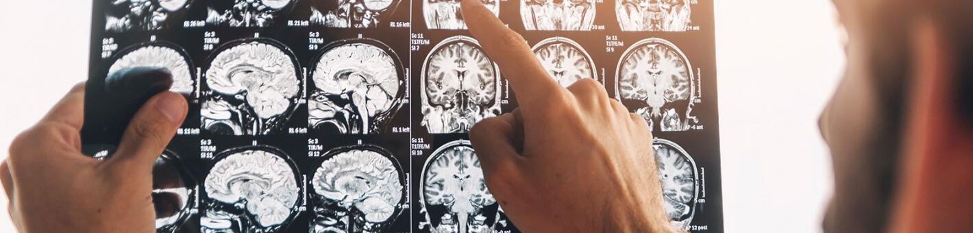 МРТ головного мозга, гипофиза (без контрастного усиления) 