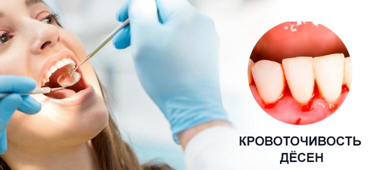 Консультация пародонтолога