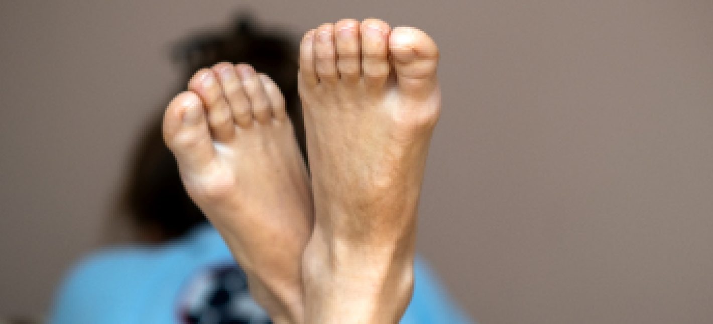 Малоинвазивная реконструктивная хирургия переднего отдела стопы