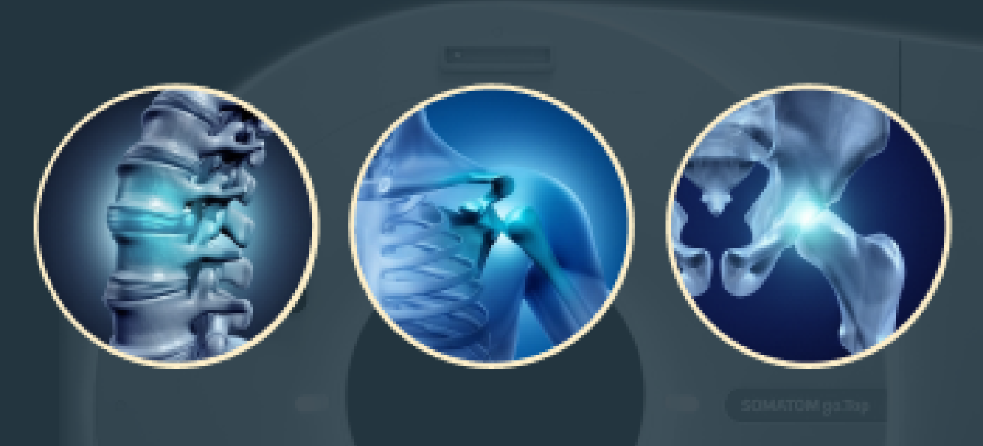 Лечебно-диагностическая блокада под КТ-навигацией